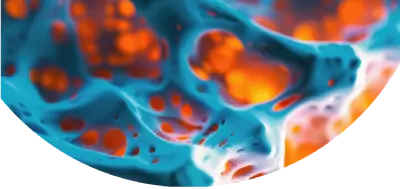 OSteoporosis Background